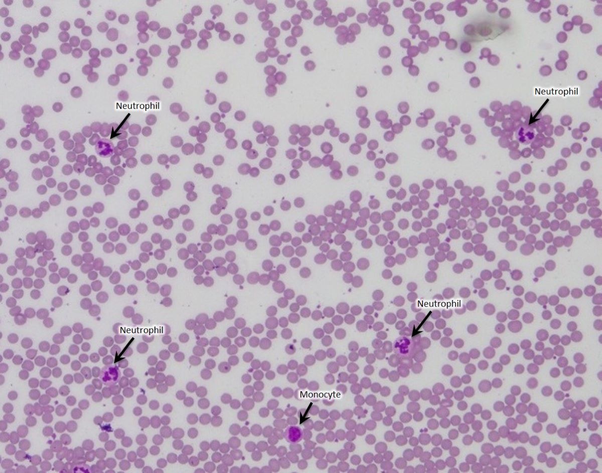 Example monkey blood smear used in the public science project. Photo: 