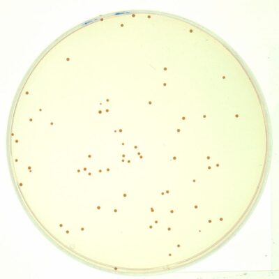 A very common bacteria called Staphylococcus aureus growing on agar in a petri dish. Photo courtesy, Creative Commons
