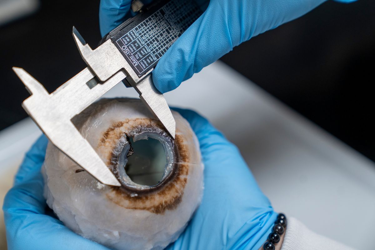 University researchers found by measuring this humpback whale eye specimen that the species has limited visual acuity. Photo: Michael Spencer/UNCW